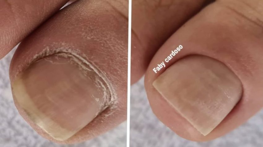 #Top3 Cutilagens Dos Pés Que Vão Te Surpreender Com O Resultado