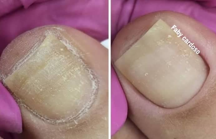 Qual A Importância De Fazer O Polimento Nas Unhas